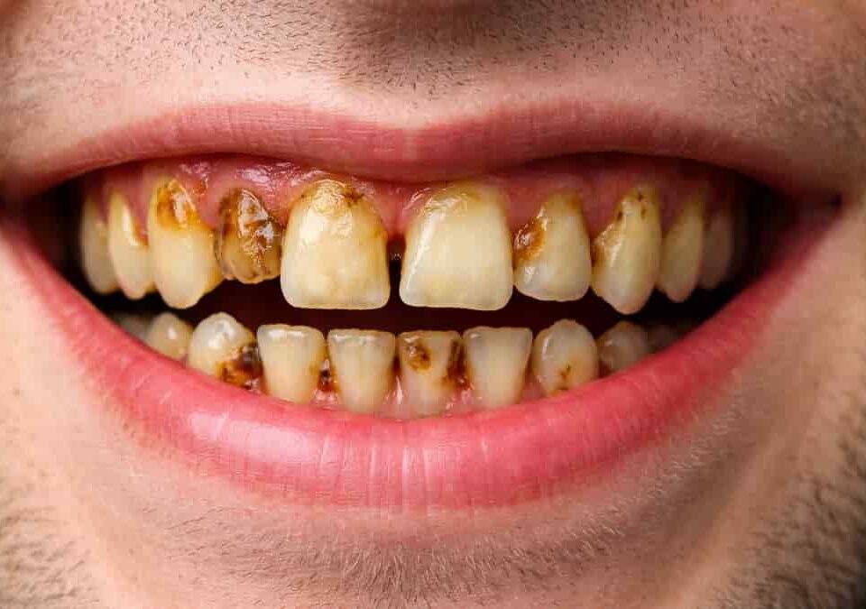 overseas dentist plans spark debate as UK dental workforce pressures grow