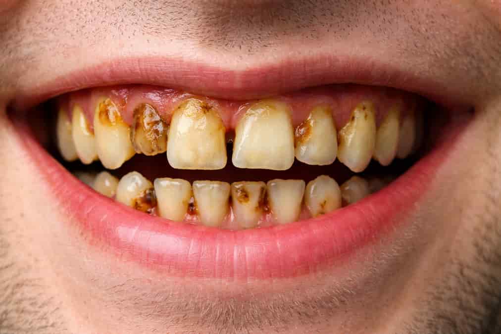 overseas dentist plans spark debate as UK dental workforce pressures grow